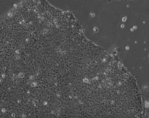 Image of human induced pluripotent stem cells
