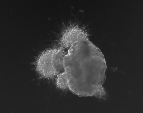 Image of 3D neuroepithelia and neural differentiation in cerebral organoid
