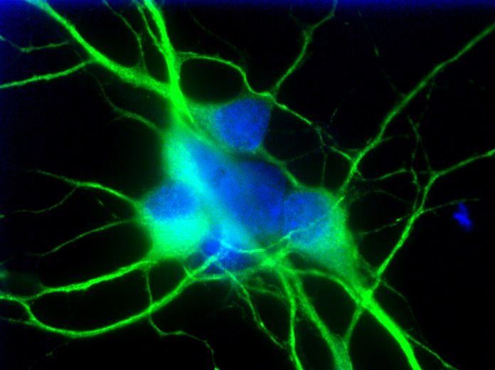 Image of Oxygen-Deprived Neuron